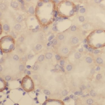 CST3 Rabbit Polyclonal Antibody