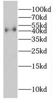 MT CYB Rabbit Polyclonal Antibody