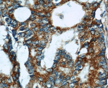 CYCS Rabbit Polyclonal Antibody