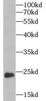 CYGB Rabbit Polyclonal Antibody