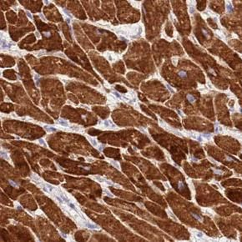 CYGB Rabbit Polyclonal Antibody