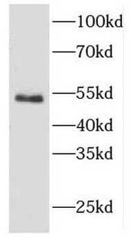 CYTH2 Rabbit Polyclonal Antibody