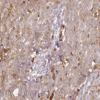 CYTH2 Rabbit Polyclonal Antibody