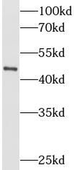 KRT16 Rabbit Polyclonal Antibody