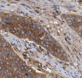 KRT16 Rabbit Polyclonal Antibody