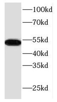 KRT17 Rabbit Polyclonal Antibody