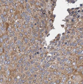 KRT17 Rabbit Polyclonal Antibody