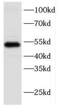 KRT17 Rabbit Polyclonal Antibody