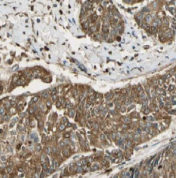 KRT17 Rabbit Polyclonal Antibody