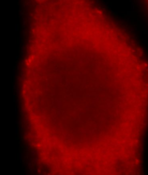 DAB2 Rabbit Polyclonal Antibody