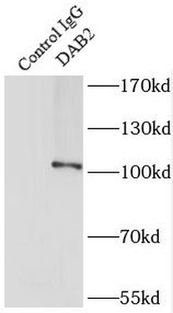 DAB2 Rabbit Polyclonal Antibody