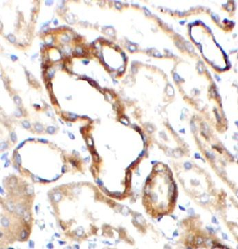 DAB2 Rabbit Polyclonal Antibody