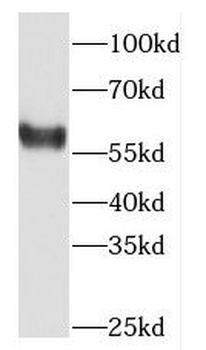 DACH2 Rabbit Polyclonal Antibody