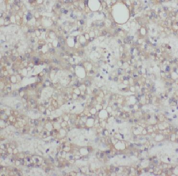DAPP1 Rabbit Polyclonal Antibody