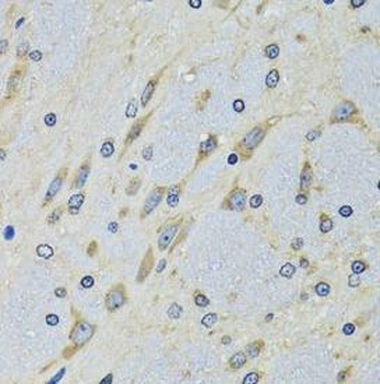 DARS1 Rabbit Polyclonal Antibody