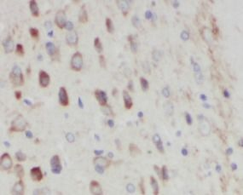 SLC6A3 Rabbit Polyclonal Antibody