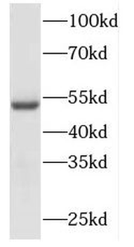 DBT Rabbit Polyclonal Antibody