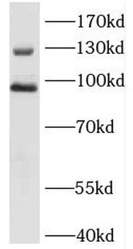 DCBLD2 Antibody