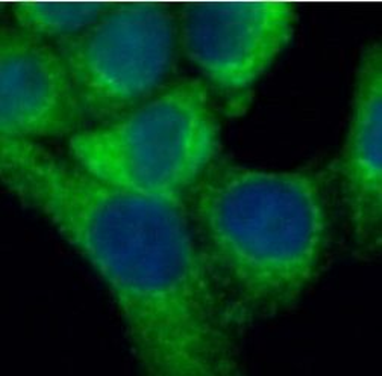 ECI1 Rabbit Polyclonal Antibody