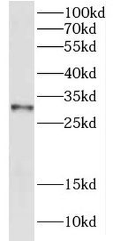ECI1 Rabbit Polyclonal Antibody