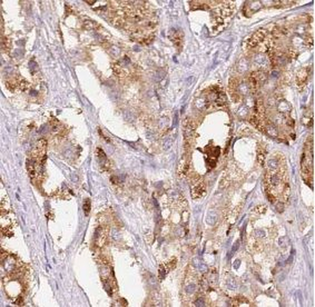 ECI1 Rabbit Polyclonal Antibody