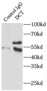 DCT Antibody