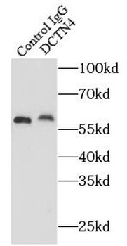 DCTN4 Rabbit Polyclonal Antibody