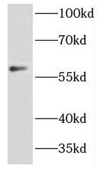 DCTN4 Rabbit Polyclonal Antibody
