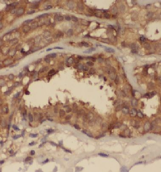 DCTN5 Rabbit Polyclonal Antibody