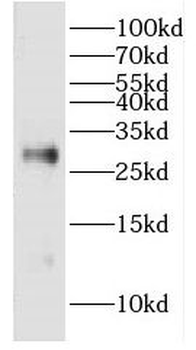 DCXR Antibody