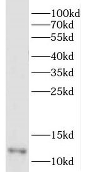DDA1 Rabbit Polyclonal Antibody