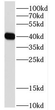 DDRGK1 Rabbit Polyclonal Antibody