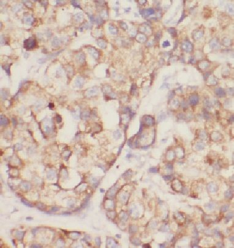 DDRGK1 Rabbit Polyclonal Antibody