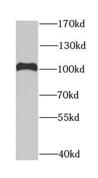 DDX1 Rabbit Polyclonal Antibody