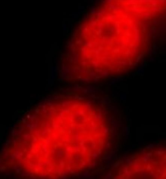 DDX17 Rabbit Polyclonal Antibody