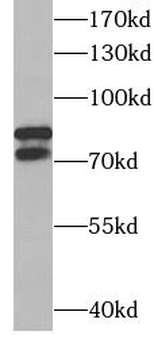 DDX17 Rabbit Polyclonal Antibody
