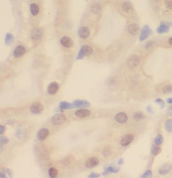 DDX17 Rabbit Polyclonal Antibody