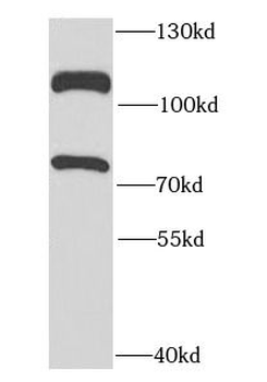 DDX20 Rabbit Polyclonal Antibody