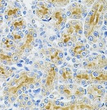 DDX20 Rabbit Polyclonal Antibody