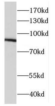DDX21 Rabbit Polyclonal Antibody