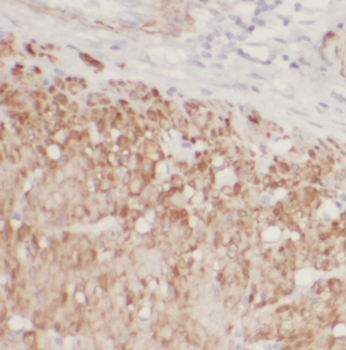 DDX21 Rabbit Polyclonal Antibody