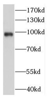 DDX23 Rabbit Polyclonal Antibody