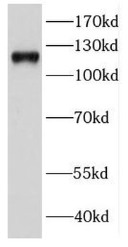 DDX24 Rabbit Polyclonal Antibody