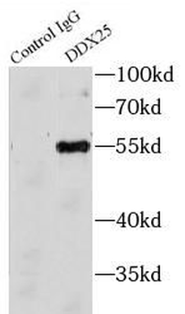 DDX25 Rabbit Polyclonal Antibody