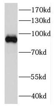 DDX27 Rabbit Polyclonal Antibody