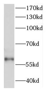DDX28 Rabbit Polyclonal Antibody