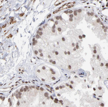 DDX28 Rabbit Polyclonal Antibody