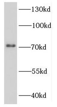 DDX3Y Rabbit Polyclonal Antibody