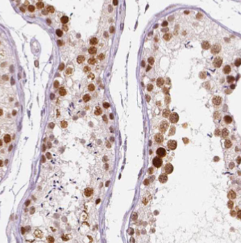 DDX3Y Rabbit Polyclonal Antibody