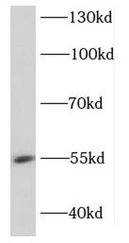 DDX49 Rabbit Polyclonal Antibody